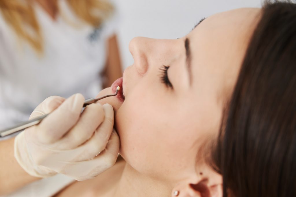 Dental practitioner putting filling material in tooth with plugger